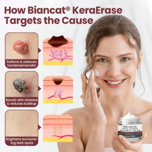Rekulo® KeraErase Dual-Action Renewal Cream