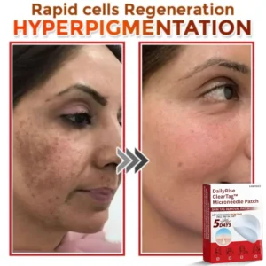 DailyRise ClearTag™ Microneedle Patch