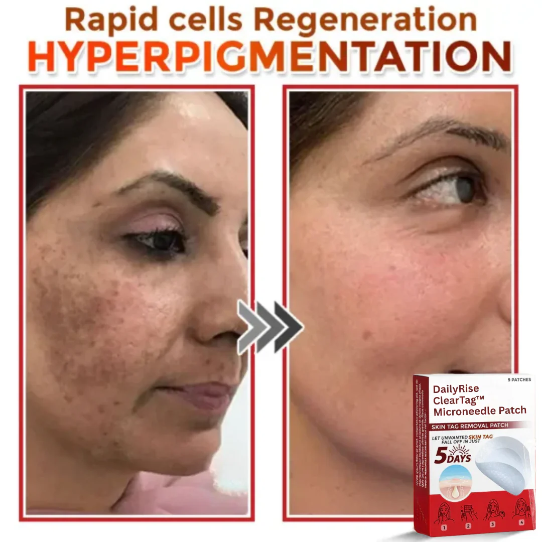 DailyRise ClearTag™ Microneedle Patch