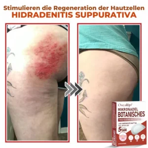 Oveallgo® MicroNeedle PLUS Botanical Day Clear Patch