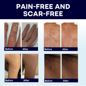 AAFQ® WartLock Cryo Recovery Spray