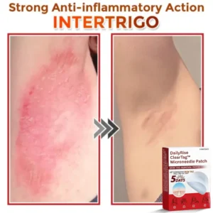 DailyRise ClearTag™ Microneedle Patch