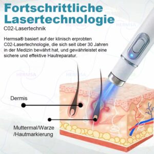 Hermsa® non-invasive laser pointer