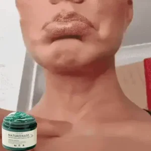 LOVILDS™ NatureErase Instant Mole & Spot Removal Gel image LOVILDS™ NatureErase Instant Mole & Spot Removal Gel