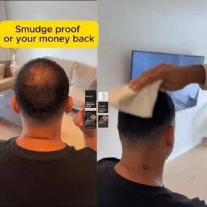 Slimoly™ Hair & Scalp Concealer 50ML