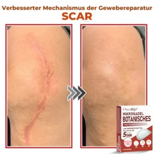 Oveallgo® MicroNeedle PLUS Botanical Day Clear Patch