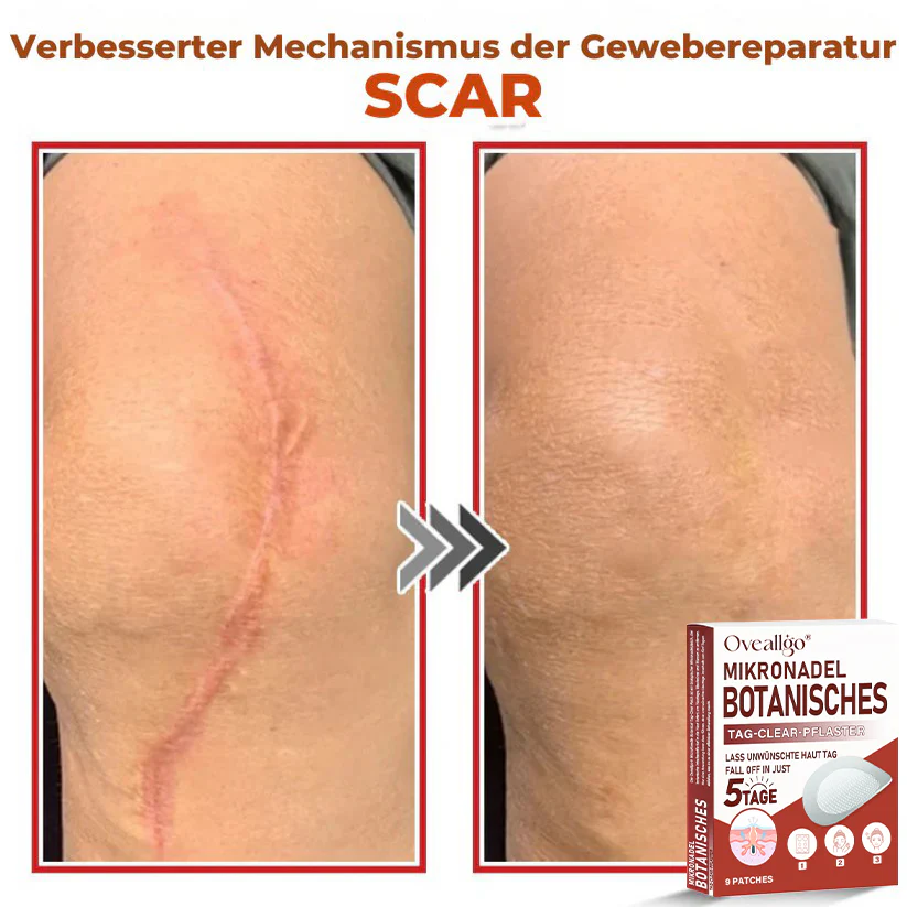 Oveallgo® MicroNeedle PLUS Botanical Day Clear Patch