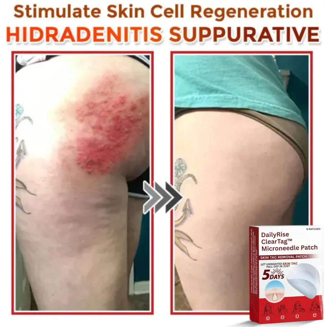 DailyRise ClearTag™ Microneedle Patch