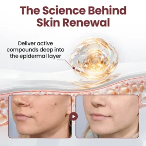 Rekulo® KeraErase Dual-Action Renewal Cream