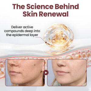 BBOJI® KeratinEase Dual-Action Renewal Cream