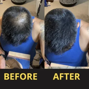 Slimoly™ Hair & Scalp Concealer 50ML