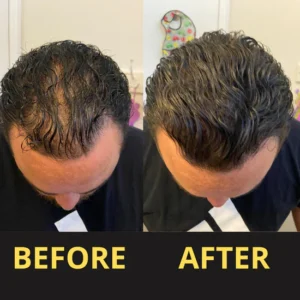 Slimoly™ Hair & Scalp Concealer 50ML