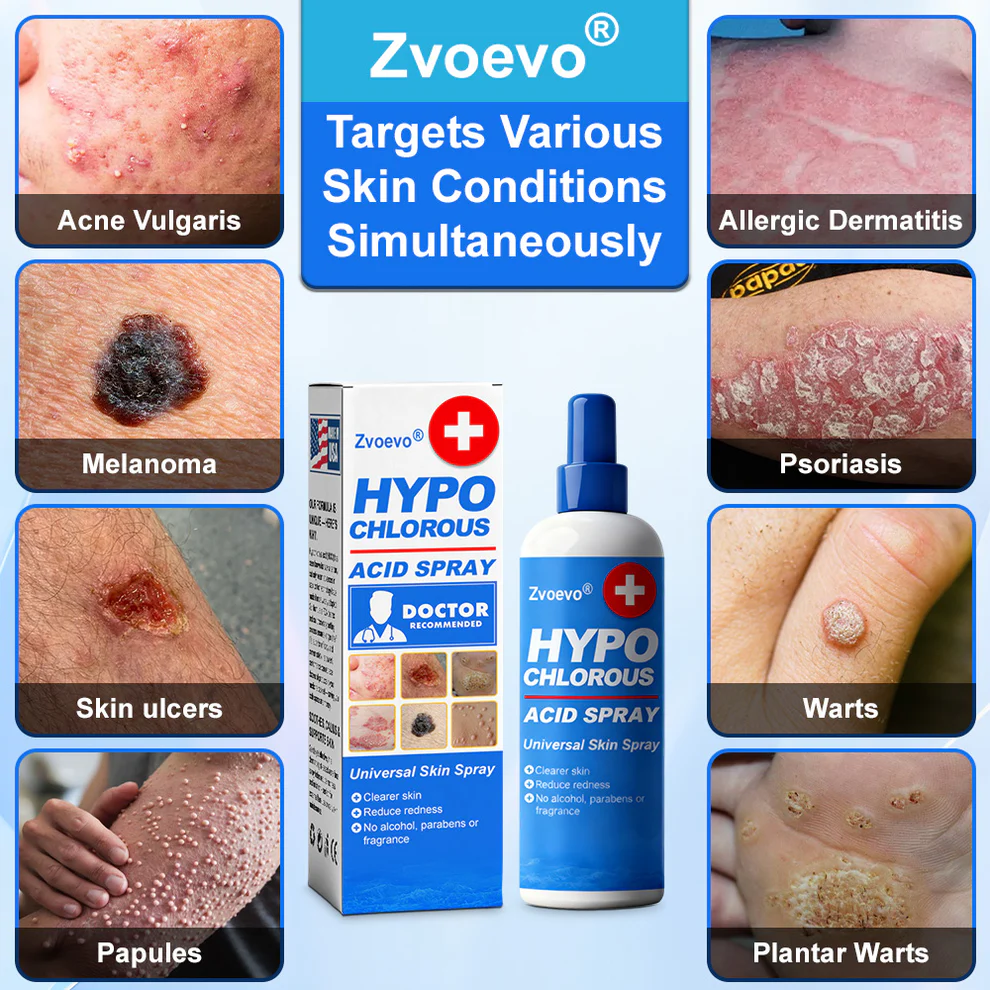 Zvoevo Hypochlorous Acid Spray image Zvoevo Hypochlorous Acid Spray