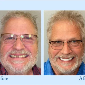 BBOJI™ Fluoride-Free Hydroxyapatite Toothpaste image BBOJI™ Fluoride-Free Hydroxyapatite Toothpaste