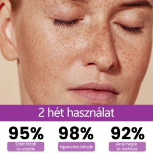 Ceoerty® MelantraX Advanced Anti-Hyperpigmentation Essence image Ceoerty® MelantraX Advanced Anti-Hyperpigmentation Essence