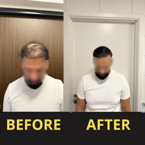 Slimoly™ Hair & Scalp Concealer 50ML