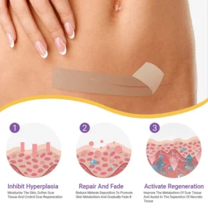 Bostore® hyaluronic acid nano micro-needle regenerating patch image Bostore® hyaluronic acid nano micro-needle regenerating patch