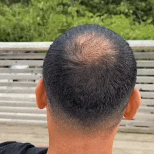 Slimoly™ Hair & Scalp Concealer 50ML