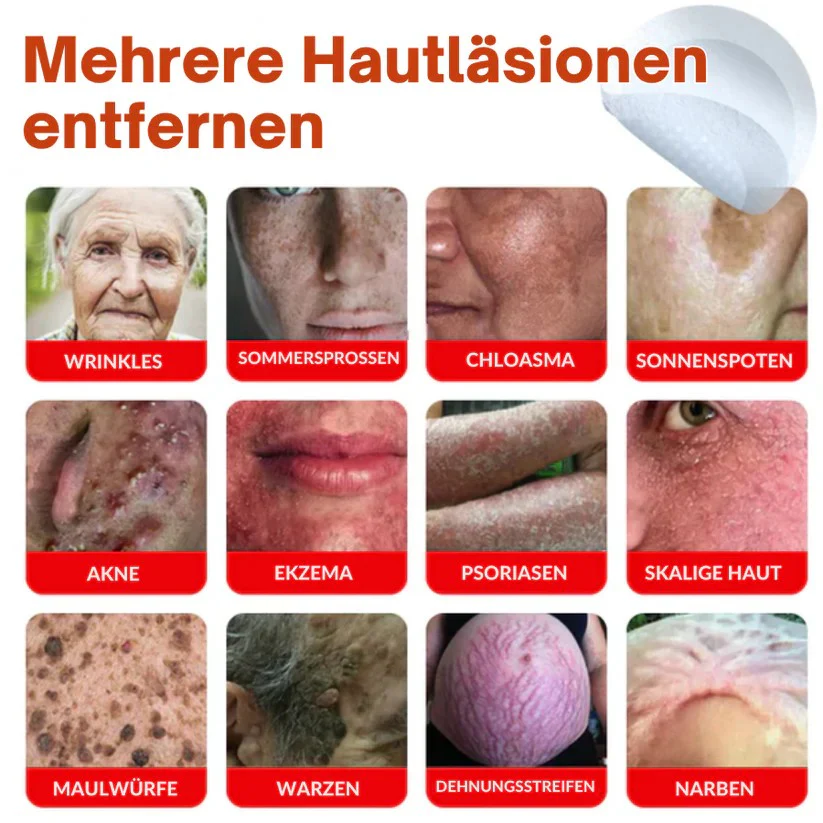 Oveallgo® MicroNeedle PLUS Botanical Day Clear Patch