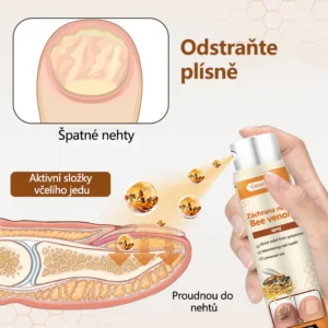 Ceoerty® NailRescue Bee Venom Spray