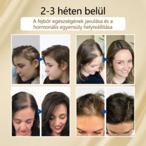 Timilk® VitaStrand Biotin Hair Growth Spray