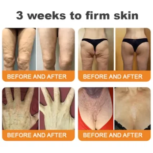 DarkFairy® Bee Venom Skin Restoration Cream
