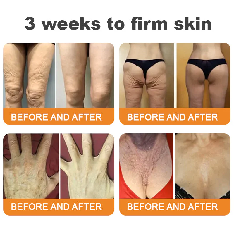 DarkFairy® Bee Venom Skin Restoration Cream