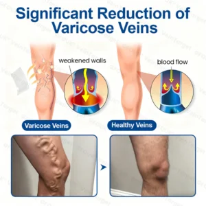 GFOUK® VeinTarget microneedle patches