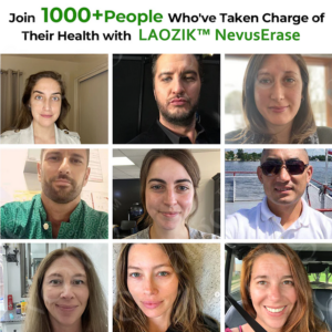 LAOZIK™ NatureErase Instant Mole & Spot Cream