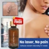 MD Quick Tattoo Removal Serum