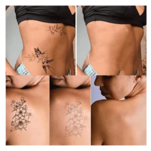 MD Quick Tattoo Removal Serum