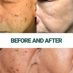 Luxevéria Spot Fading Gel