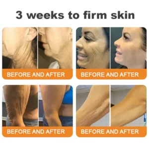 DarkFairy® Bee Venom Skin Restoration Cream