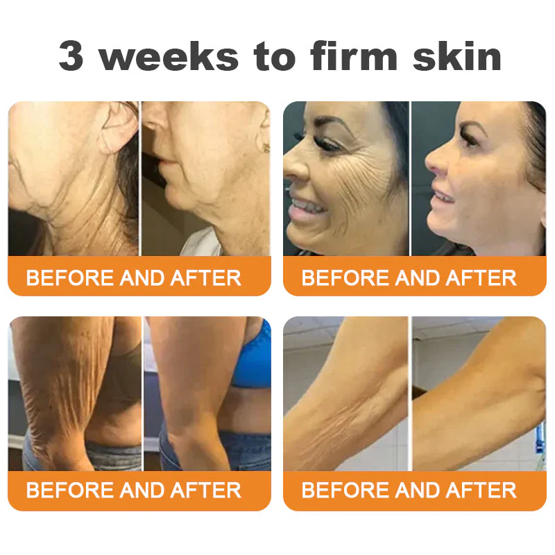 DarkFairy® Bee Venom Skin Restoration Cream