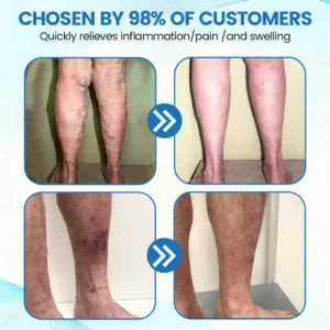 Ourlyard® VascuCare Vein Healing Spray