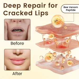 Ceoerty® BeeLixir Lip Repair Balm