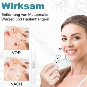 Hermsa® non-invasive laser pointer