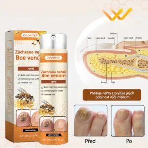 Ceoerty® NailRescue Bee Venom Spray
