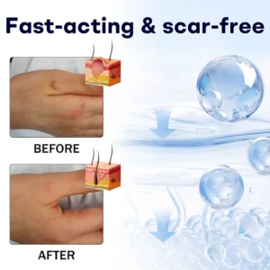 AAFQ® WartLock Cryo Recovery Spray