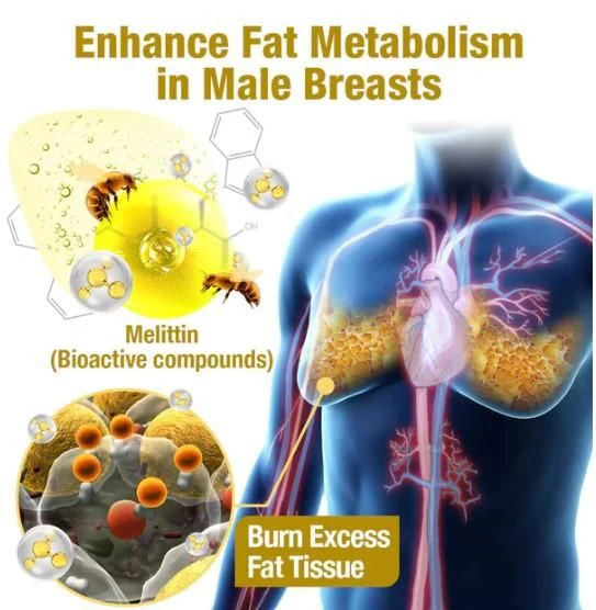 Chest Fat Bee Venom Gynecomastia Heating Oil image Chest Fat Bee Venom Gynecomastia Heating Oil