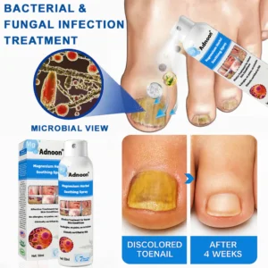 ADNOON Natural Magnesium Herbal Psoriasis Spray