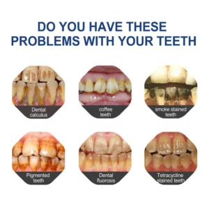 BBOJI™ Fluoride-Free Hydroxyapatite Toothpaste image BBOJI™ Fluoride-Free Hydroxyapatite Toothpaste