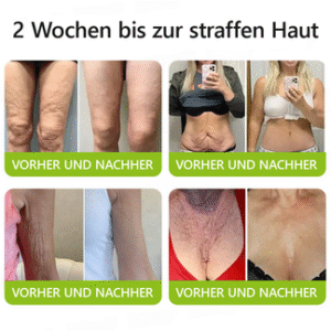 STDEI Botox Vita A Retinol Shot