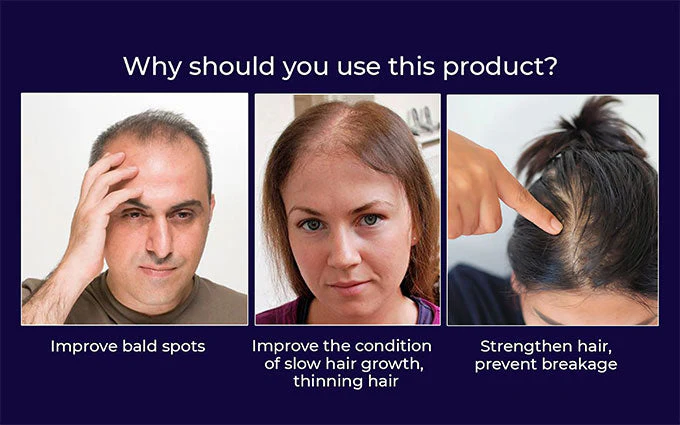 HZA™ Natural Hair Regrowth Spray