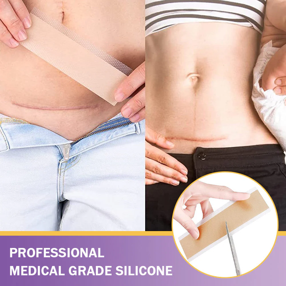 BBOJI® The Scar Cream Lie: Why 99% of Treatments Can't Work - Image 4