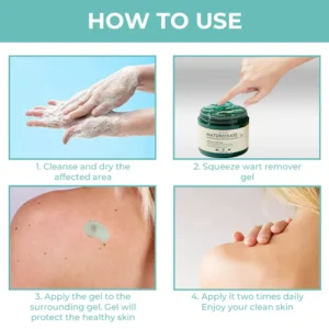 LOVILDS™ NatureErase Instant Mole & Spot Removal Gel image LOVILDS™ NatureErase Instant Mole & Spot Removal Gel