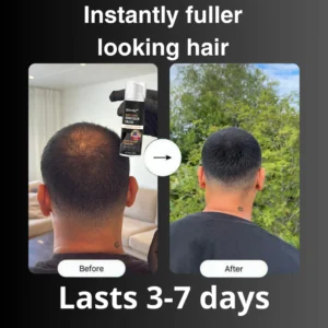 Slimoly™ Hair & Scalp Concealer 50ML