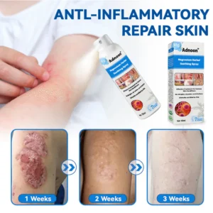 ADNOON Natural Magnesium Herbal Psoriasis Spray