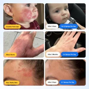 Zvoevo Hypochlorous Acid Spray image Zvoevo Hypochlorous Acid Spray