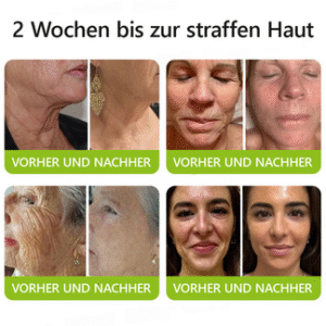 STDEI Botox Vita A Retinol Shot